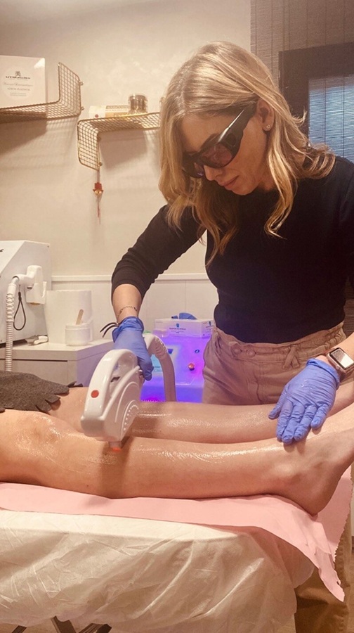 Depilacion lasero